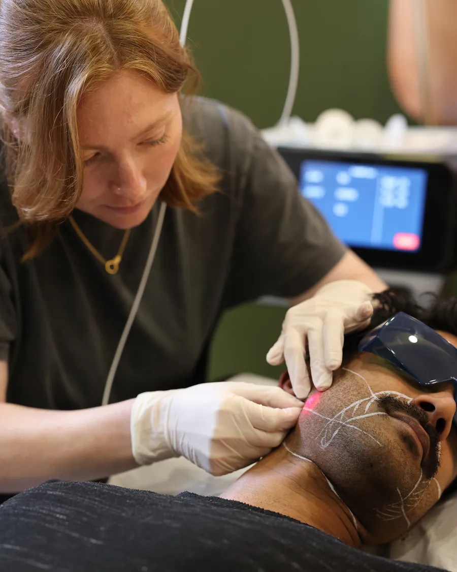 Dr Ellie guiding the Endolift laser fibre mid-treatment