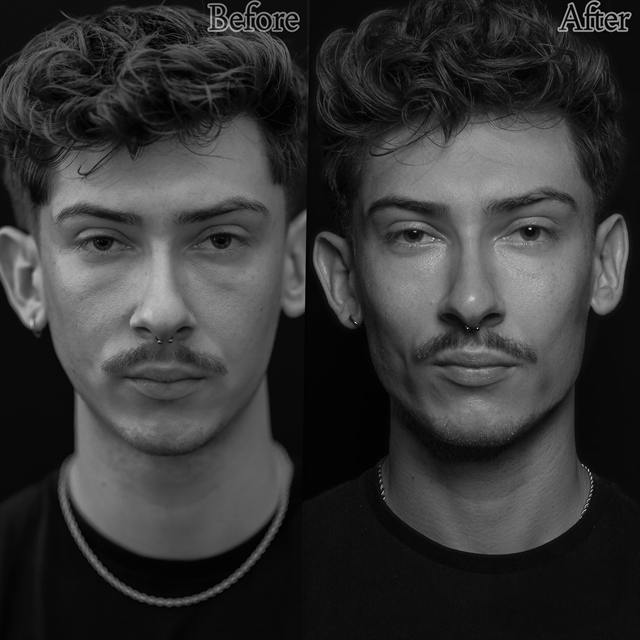Unretouched before and after result, the drBand Clinic