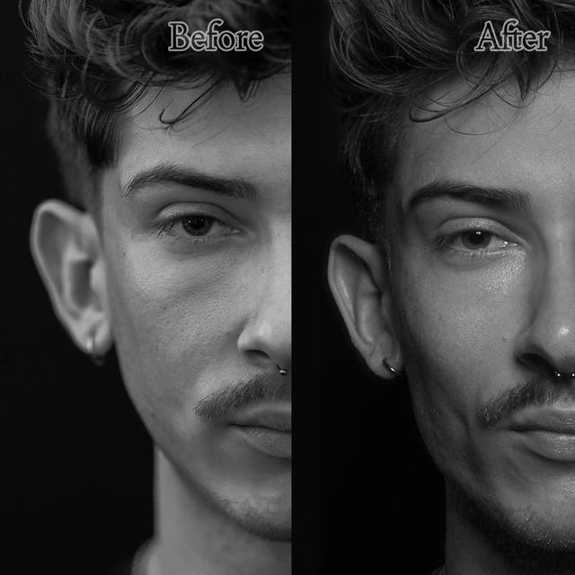 Unretouched before and after result, the drBand Clinic
