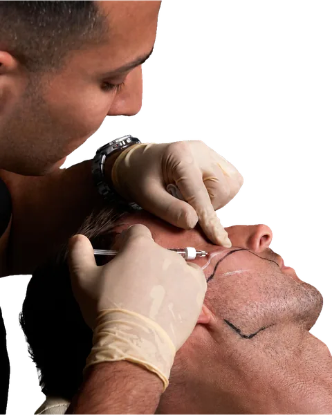 Dr Band mid-treatment, placing filler along a patient's marked jawline