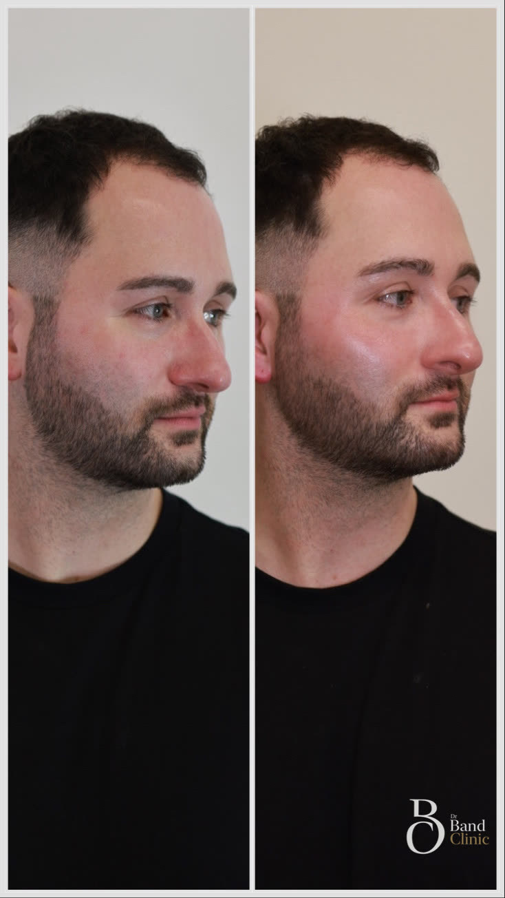 Full face harmonisation, unretouched