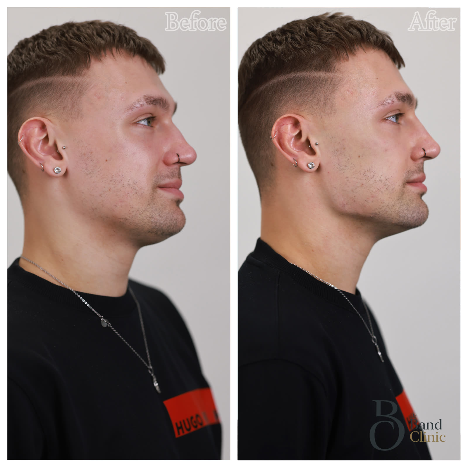 Mid-face + jaw balance, unretouched