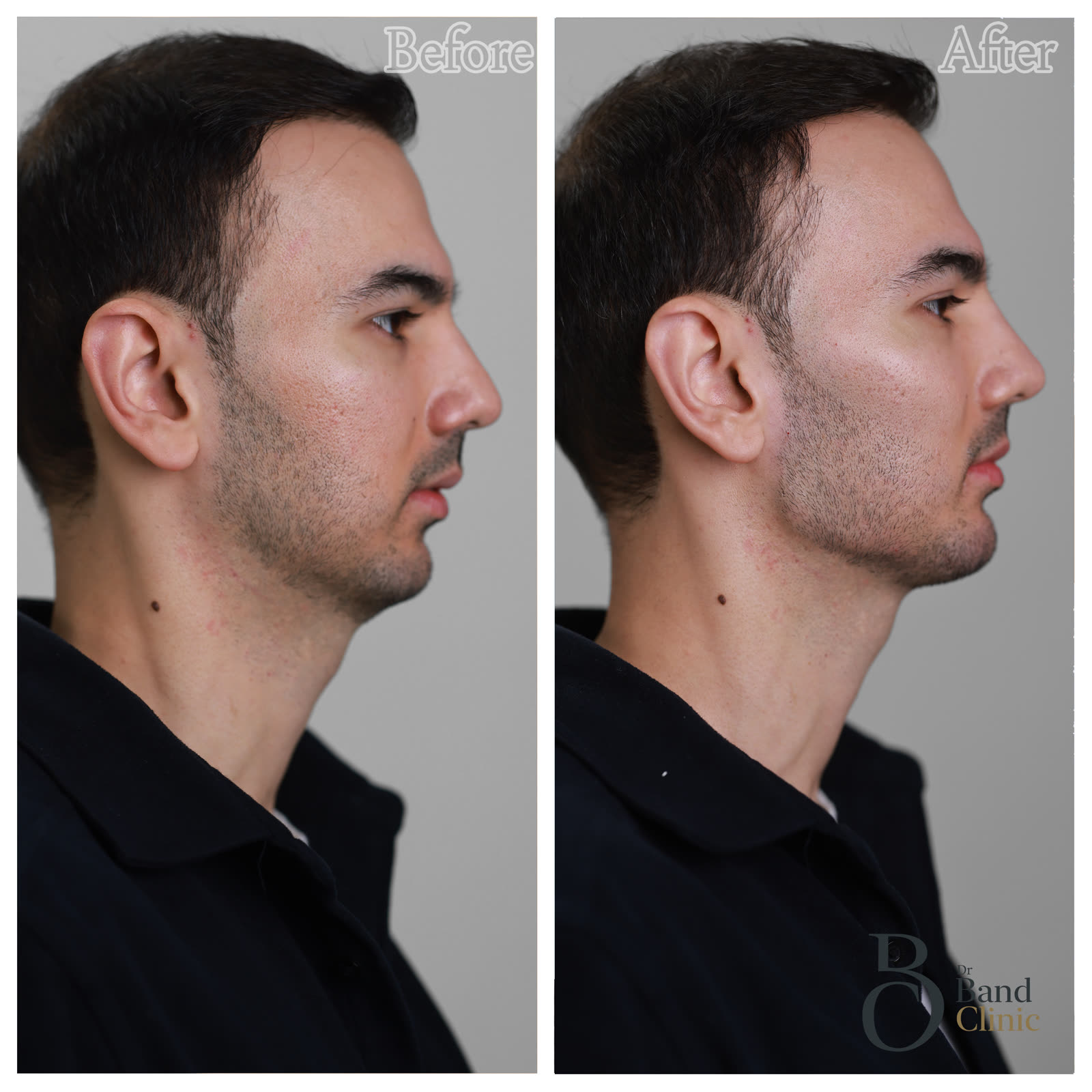 Multi-modality restoration, unretouched