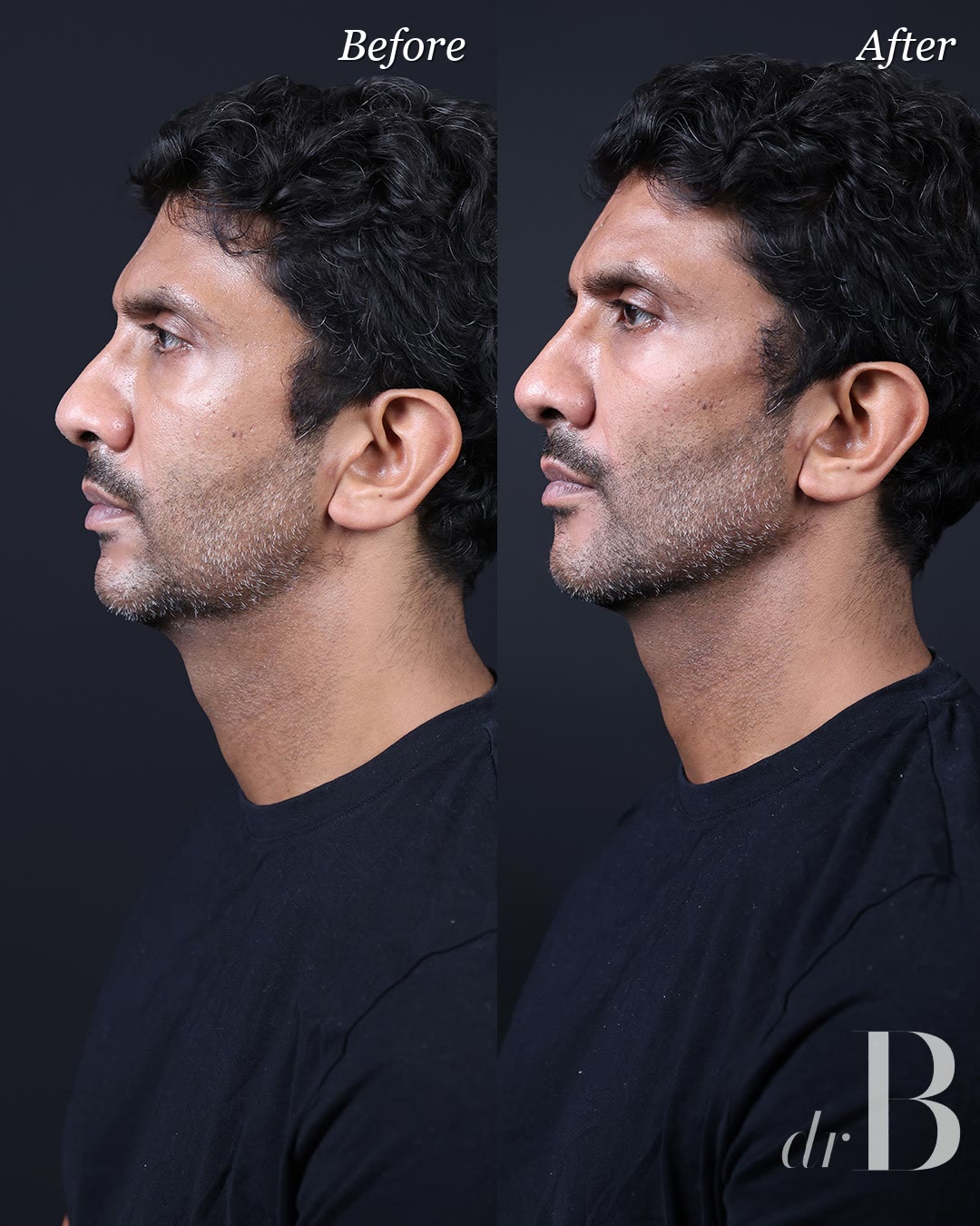A full Band Codex plan on a male face, the full-face design work taught at the Masterclass