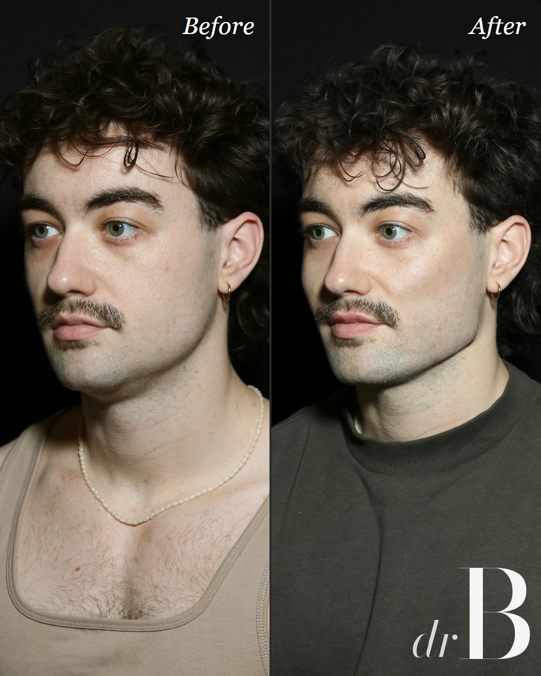 A full Band Codex plan on a male face, the full-face design work taught at the Masterclass
